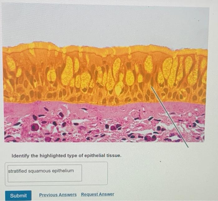 Which epithelial type is highlighted