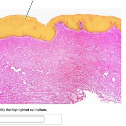 Epithelial highlighted epithelium columnar myct offset itemview answer