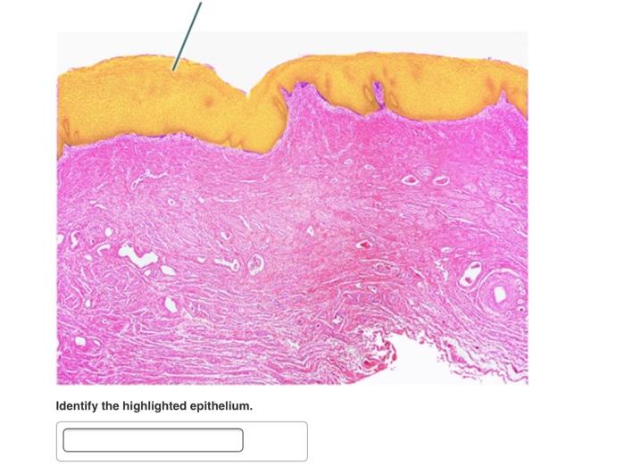 Epithelial highlighted epithelium columnar myct offset itemview answer