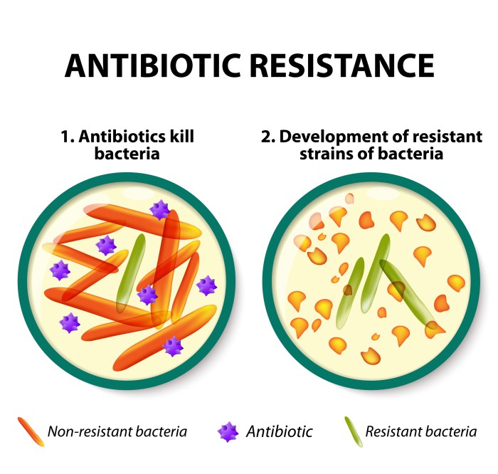 Resistance antibiotic antimicrobial antibiotics spreads cdc control disease resistant bacteria health drug spread examples against gov animals become livestock summary