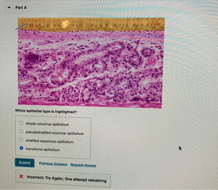 Which epithelial type is highlighted