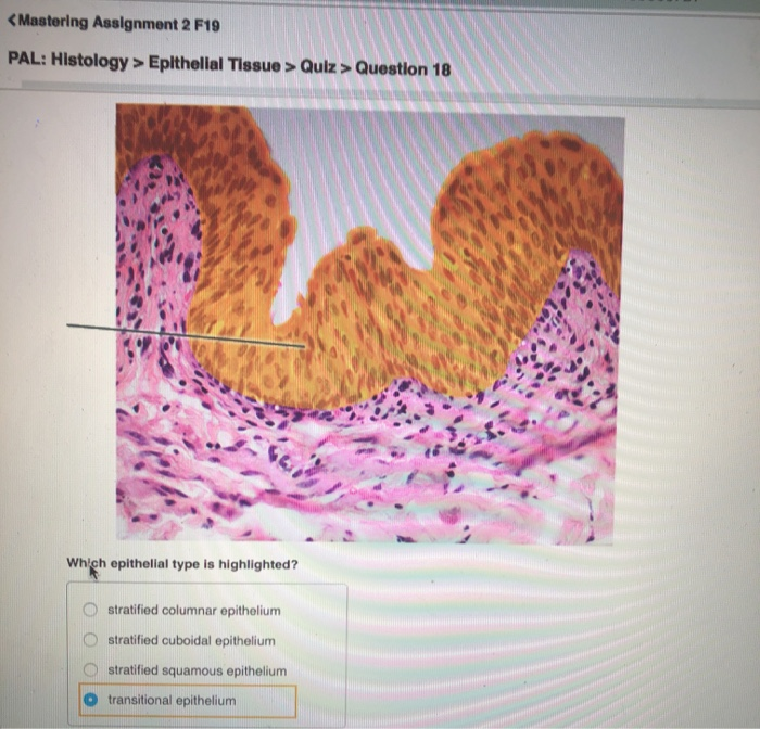 Highlighted epithelial type which ch bio lab test easynotecards